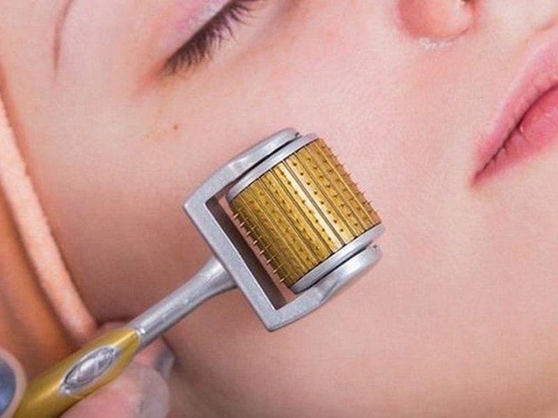 Curso de Microagulhamento em Curitiba