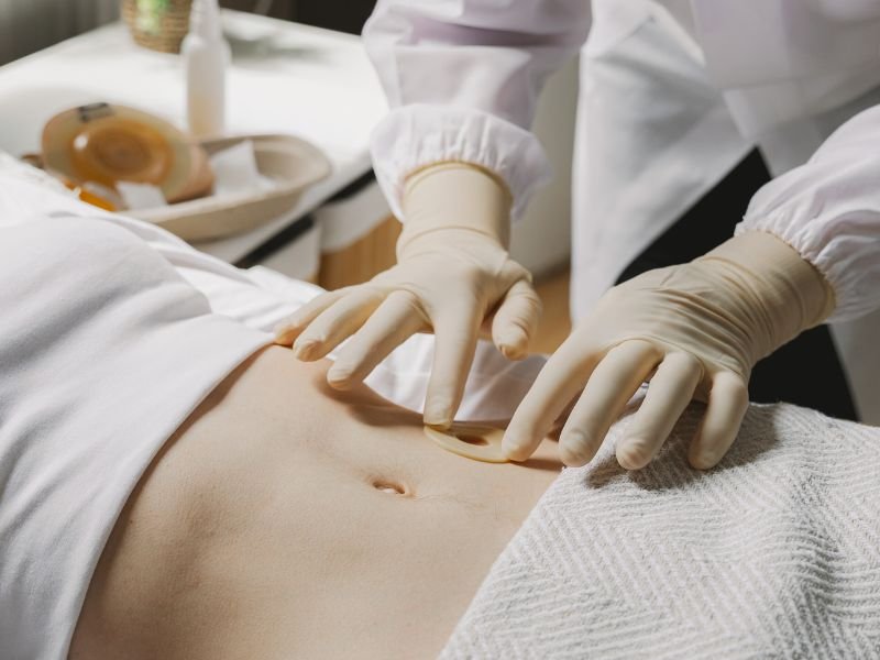 Capacitacao em imersao em pos operatorio em Curitiba