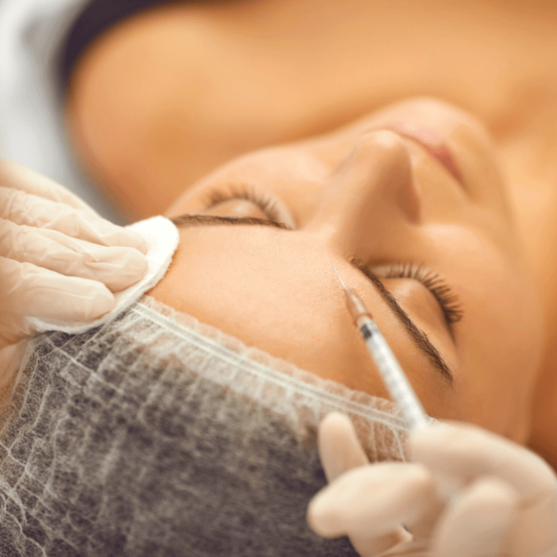 Intradermoterapia estetica curso em curitiba