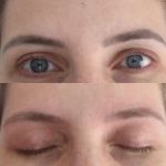 Curso de Remoção a Laser de Micropigmentação e Tatuagem (Bônus Black Peel) Curso de Remocao a Laser de Micropigmentacao e Tatuagem Bonus Black Peel
